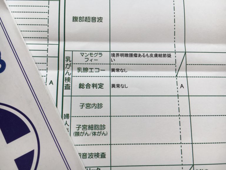 歯並びが変われば人生も変わる驚きの矯正パワーとは